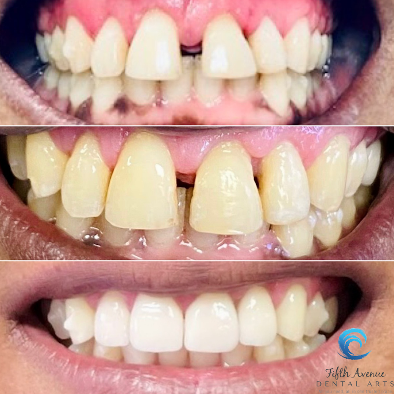 Fifth Avenue Dental Arts