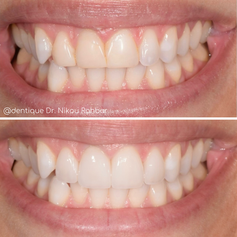 Dentique™ Cosmetic Dentistry Studio