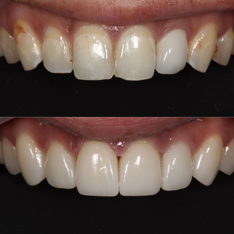 Willow Glen Dental